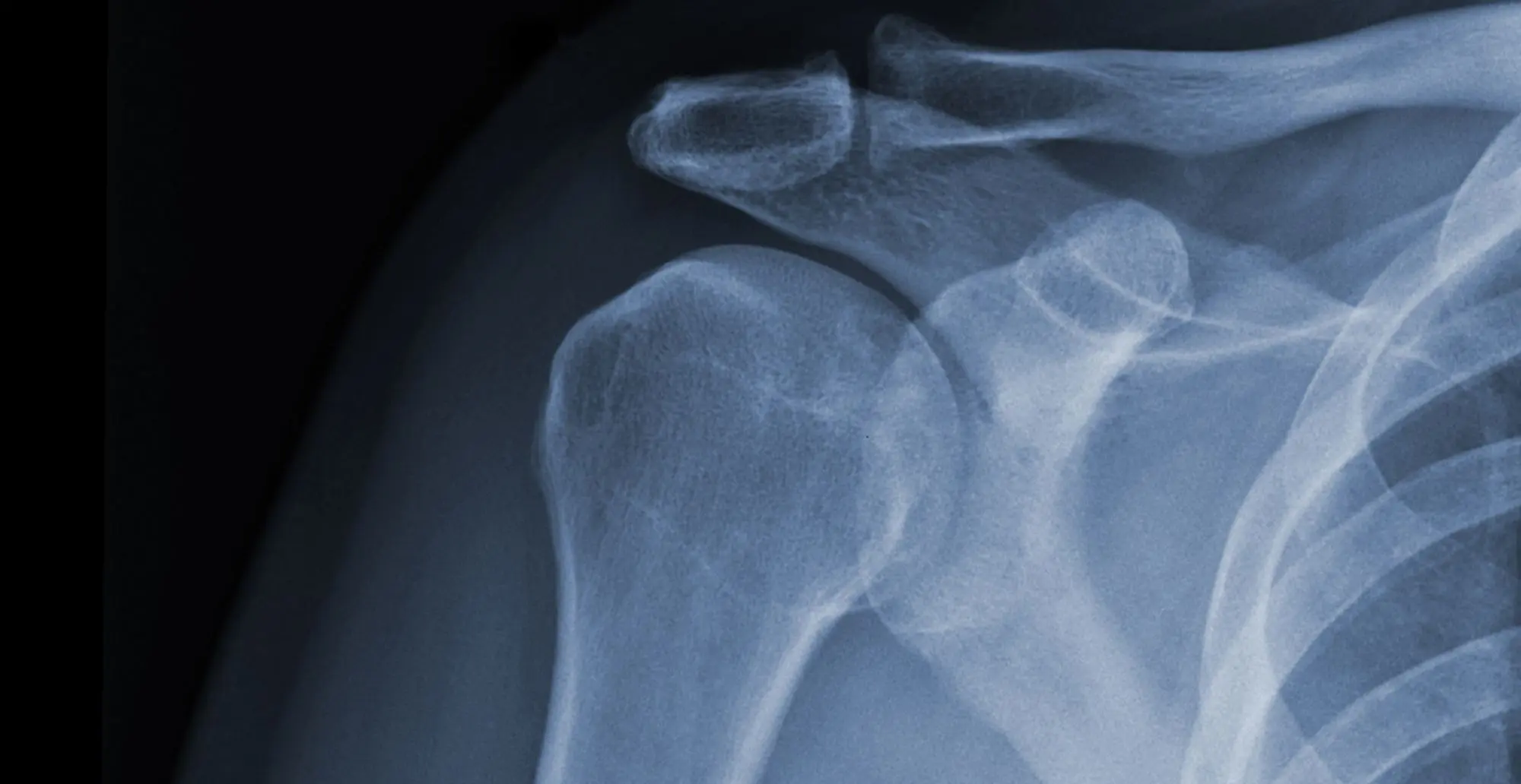 Orthopaedic hero image of xray