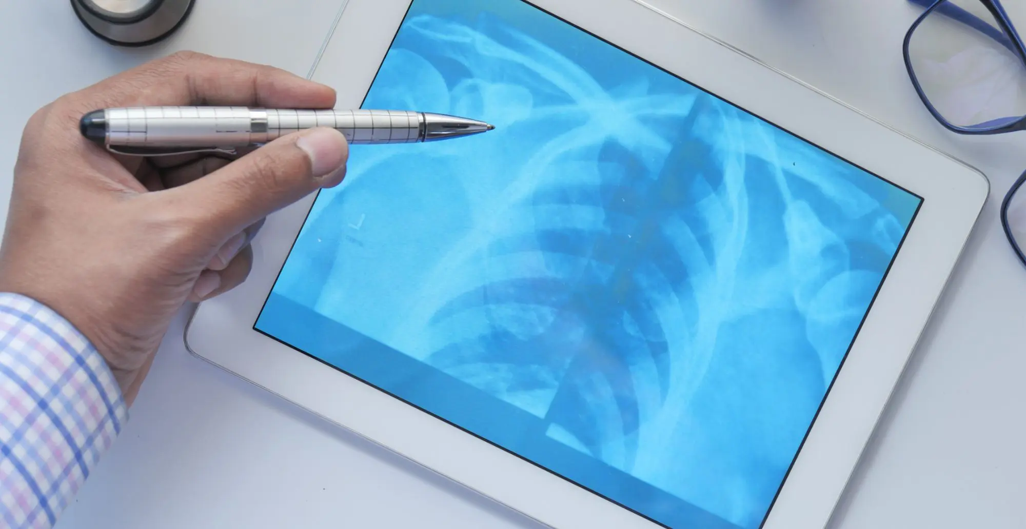 doctor explaining an xray